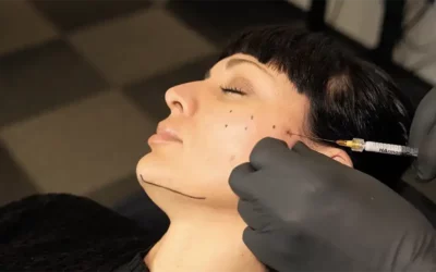 Bio-Collagen Stimulators