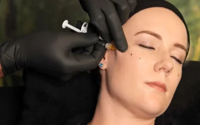 Dermal Fillers