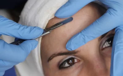 Dermaplaning