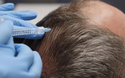 Hair Growth Factor Therapy